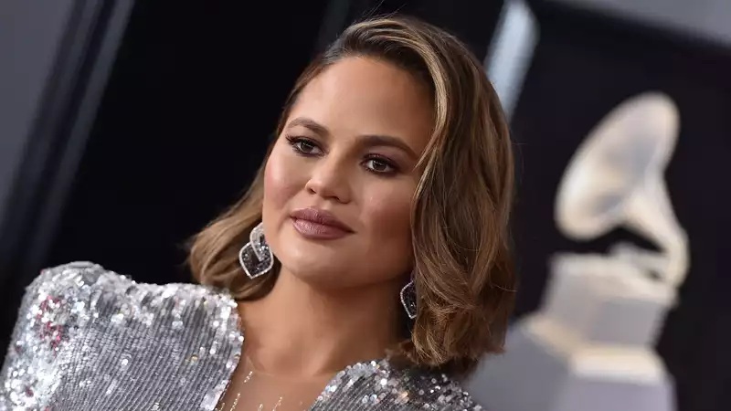 Chrissy Teigen posts a photo of her breast milk stained clothing.